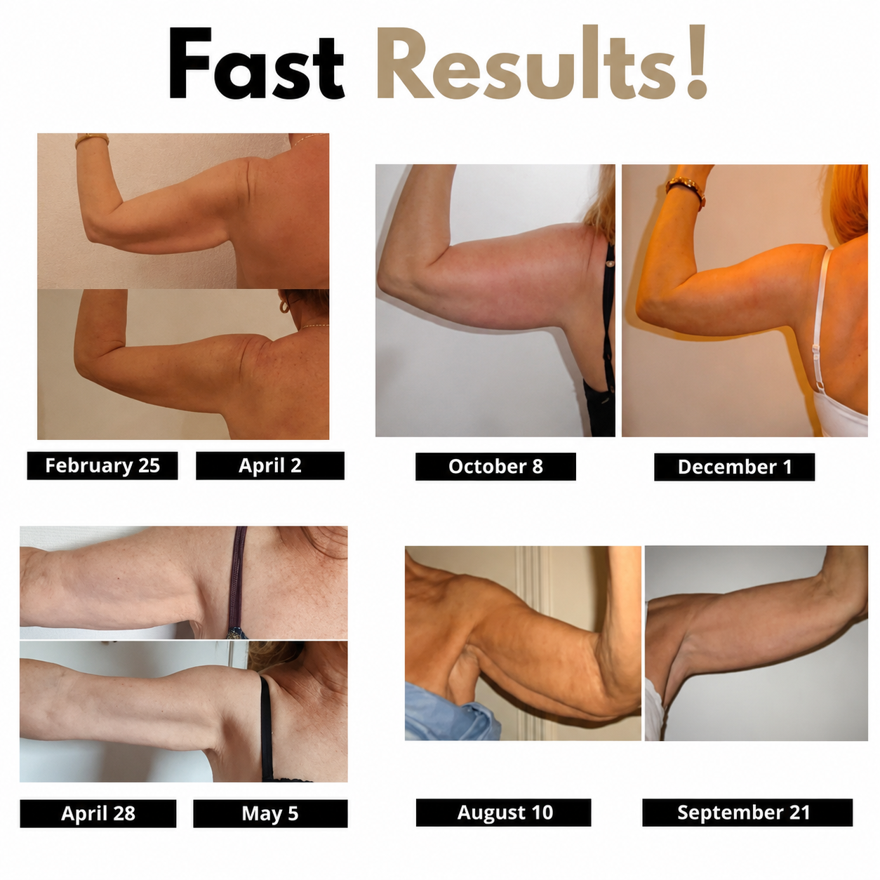 Ceralia Sculpting Sleeves